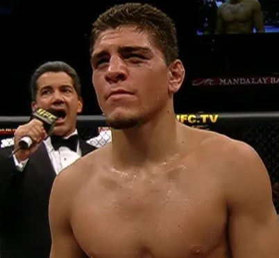 Nick Diaz Net Worth: Shocking Wealth of the MMA Legend Revealed