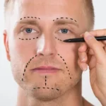 How to Find Trusted Plastic Surgery Experts Near You